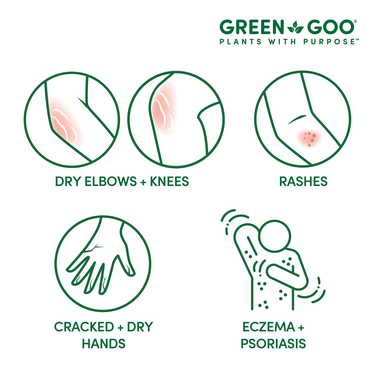 Dry Skin | Green Goo by Sierra Sage Herbs