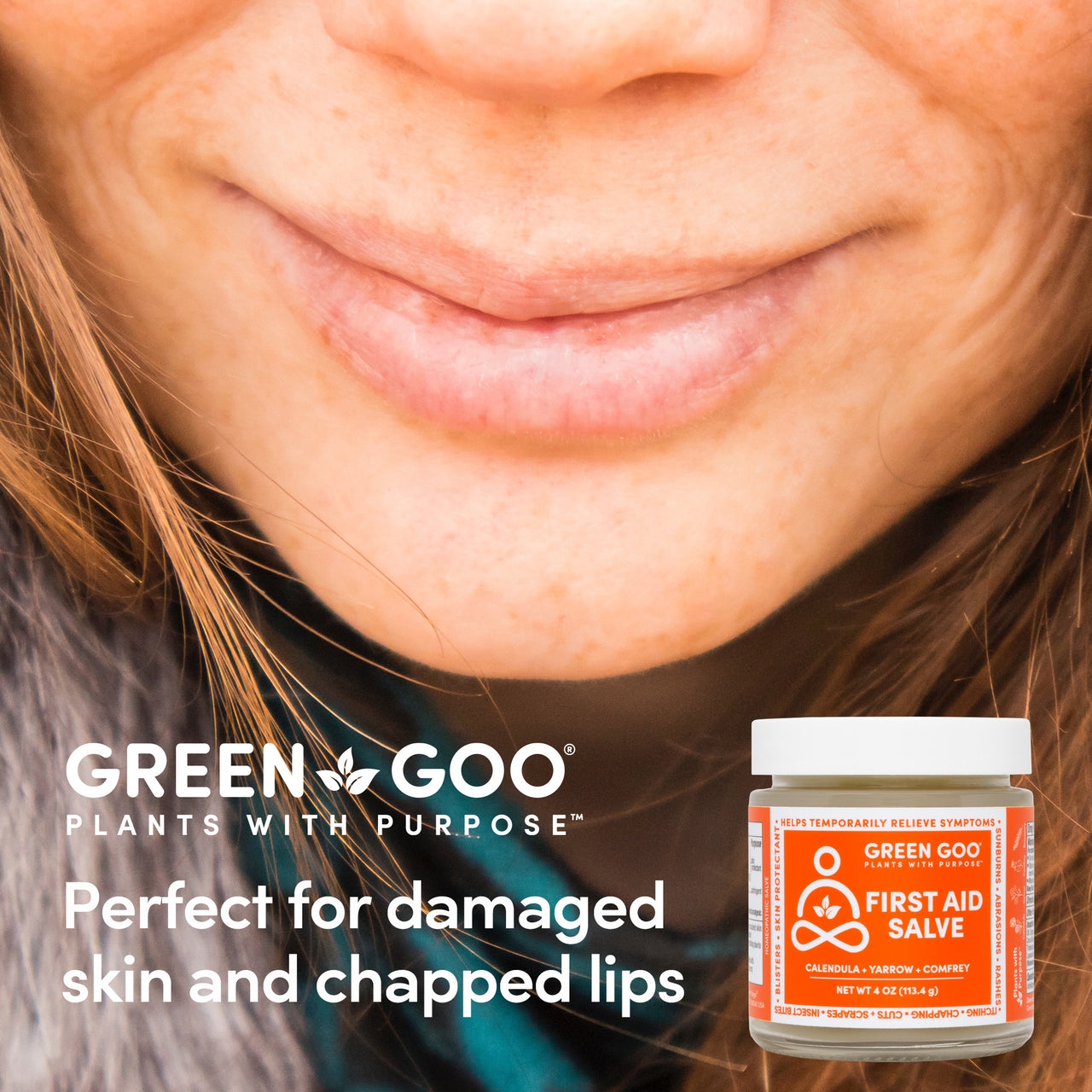 Perfect for damaged skin and chapped lips. First Aid Salve | Green Goo by Sierra Sage Herbs